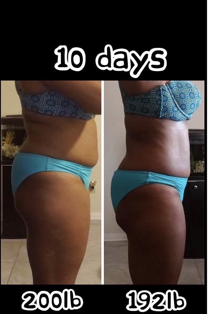 Client transformation — down 8 pounds in 10 days
